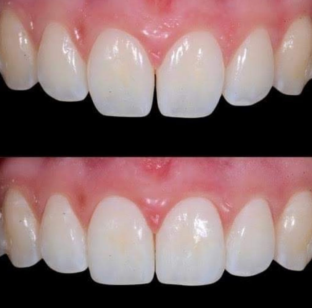 i casi clinici eseguiti presso lo studio dentistico del dott. taddia a novara