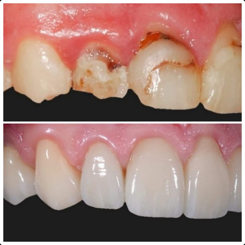 i casi clinici eseguiti presso lo studio dentistico del dott. taddia a novara