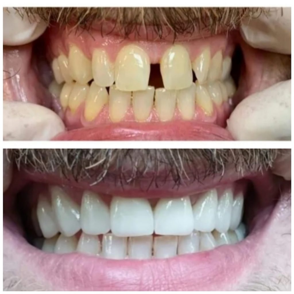 i casi clinici eseguiti presso lo studio dentistico del dott. taddia a novara