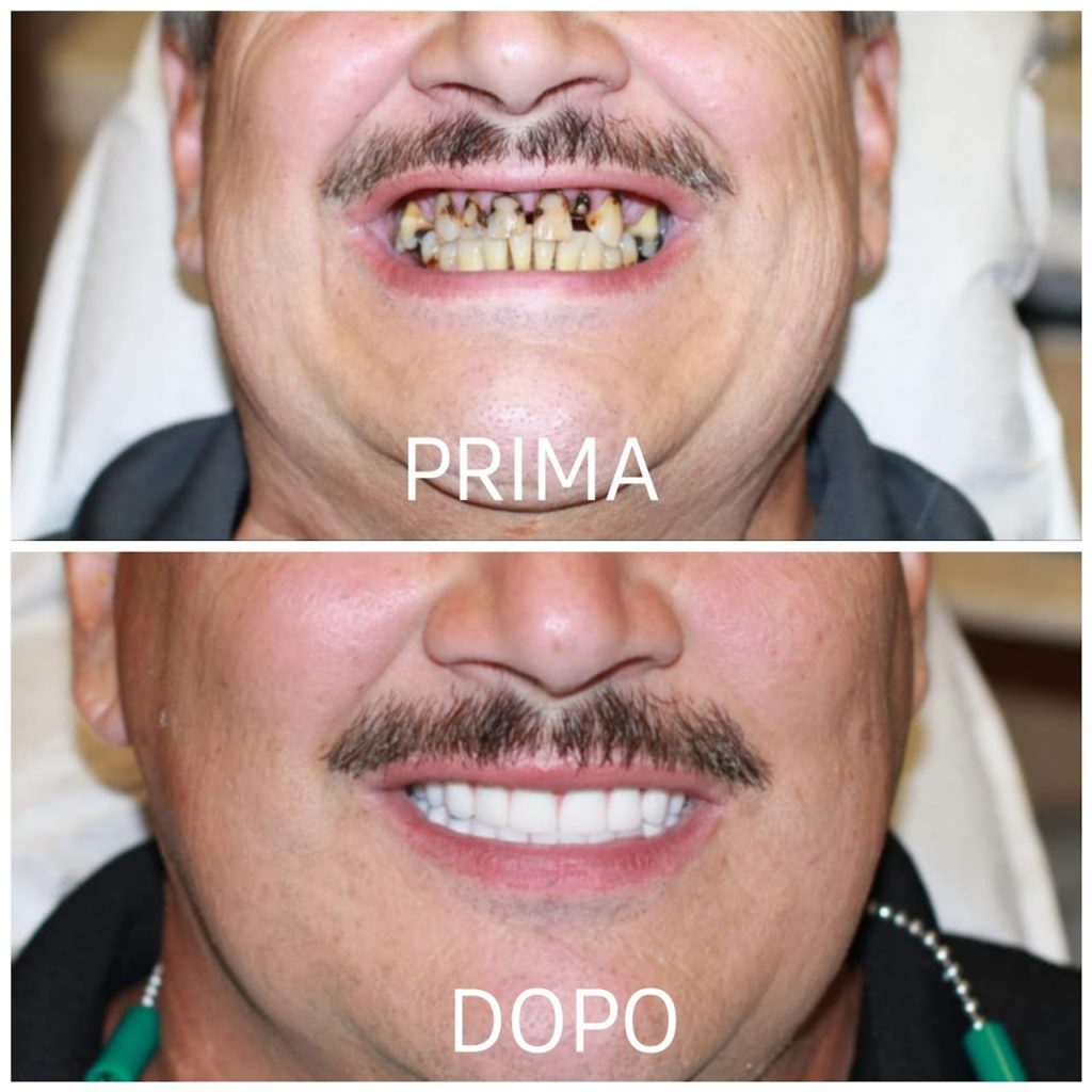 i casi clinici eseguiti presso lo studio dentistico del dott. taddia a novara
