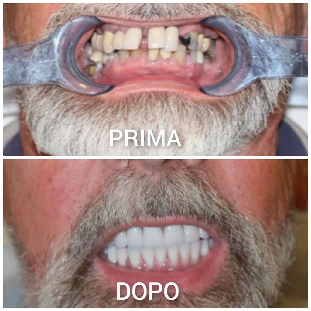 i casi clinici eseguiti presso lo studio dentistico del dott. taddia a novara
