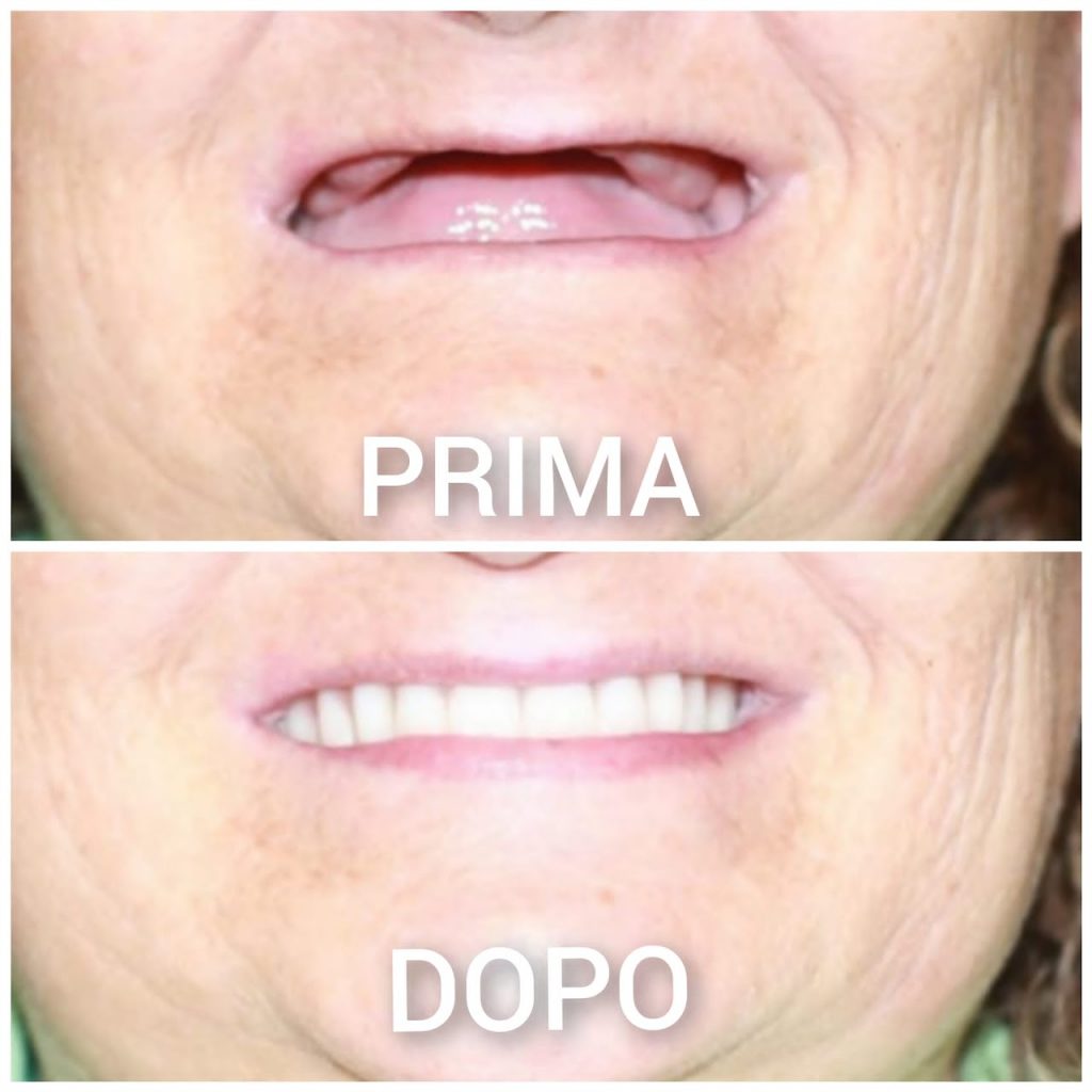 i casi clinici eseguiti presso lo studio dentistico del dott. taddia a novara